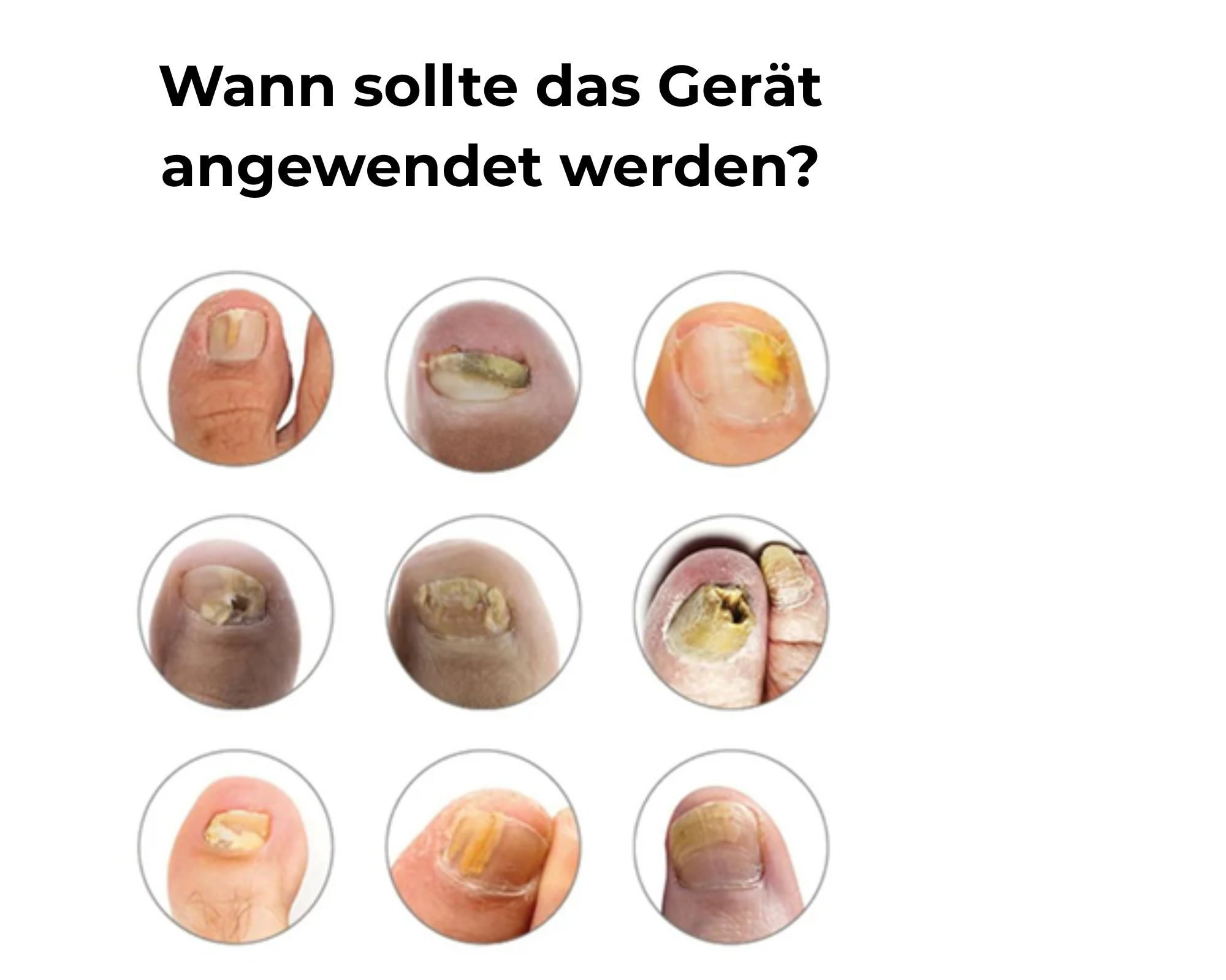 NagelVita Pro – Laser-Nagelpilz-Behandlungsgerät